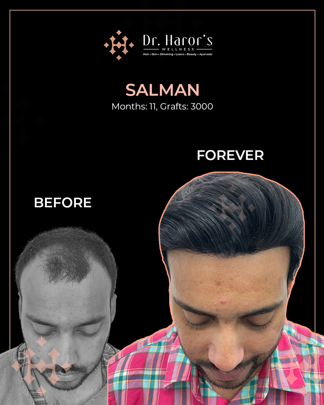 4 - Before and After